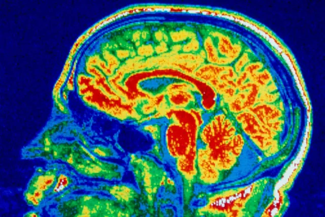 Exploring the Neurological Links Between Eating Disorders, OCD, and Autism