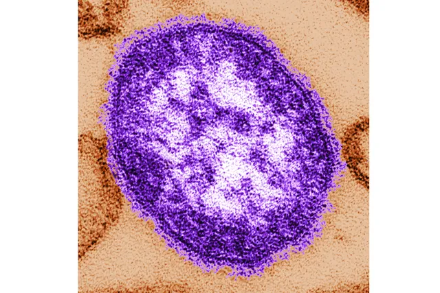 Pennsylvania Reports Third Measles Death in 2026: Unvaccinated Woman Dies