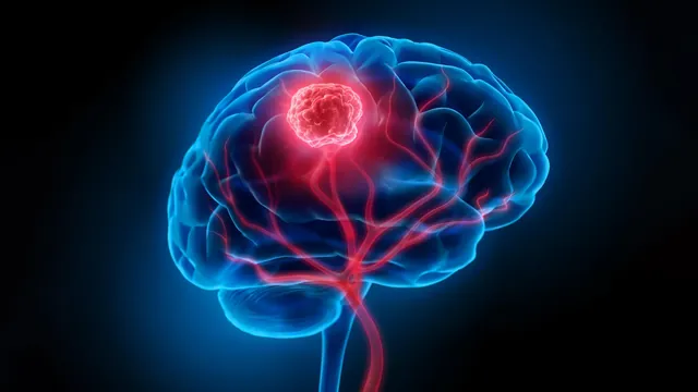 New Nanoparticles Illuminate and Destroy Hidden Brain Cancer in Mice, Offering Hope for Glioblastoma Patients