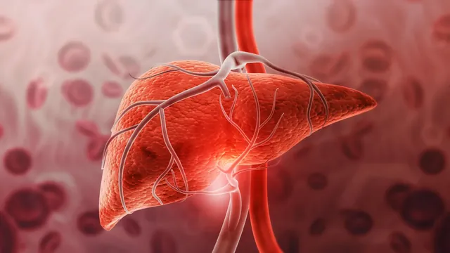 Weight-Loss Hormone GDF15 Offers Liver Protection Independent of Weight Loss